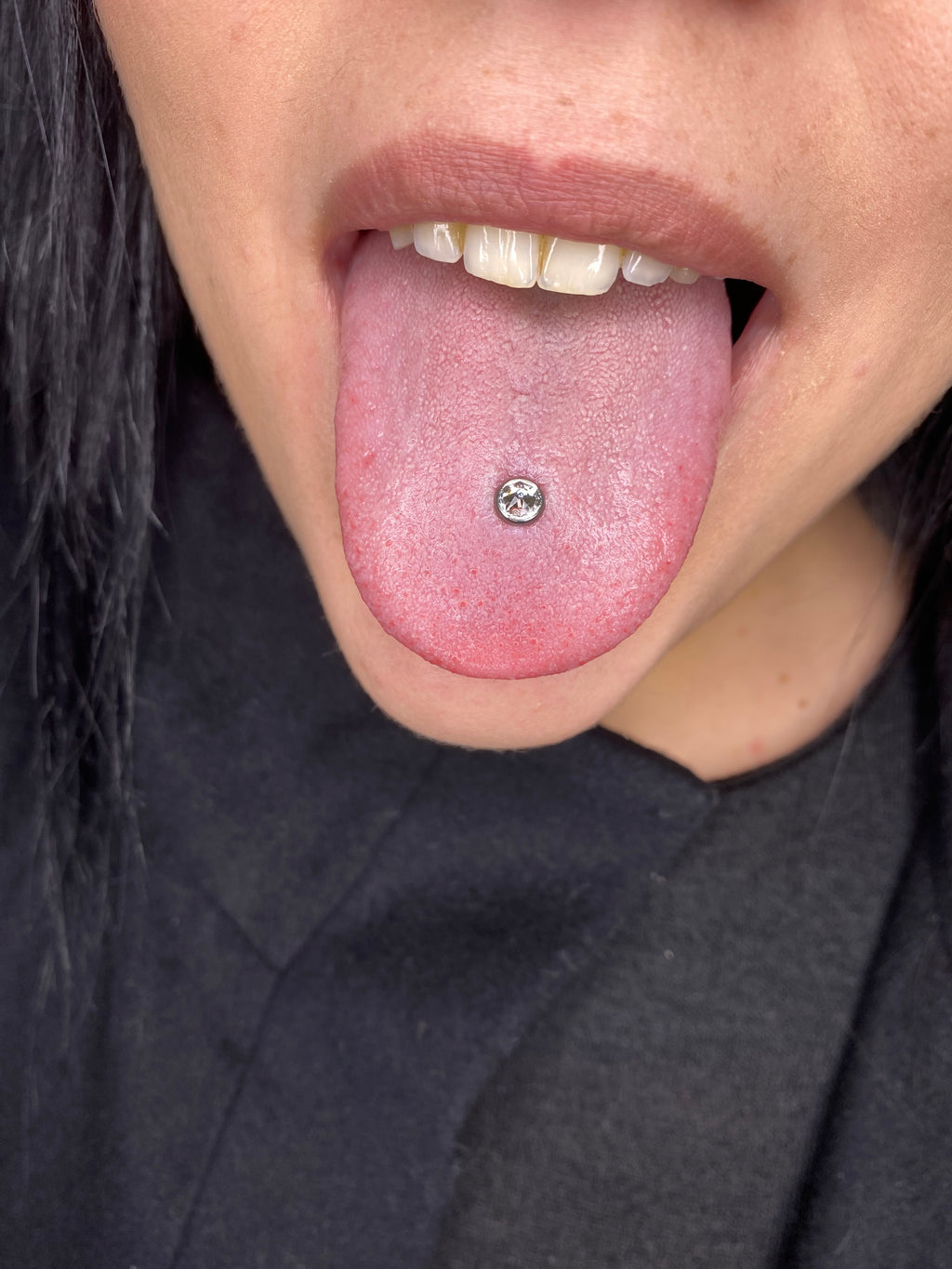 Dermal